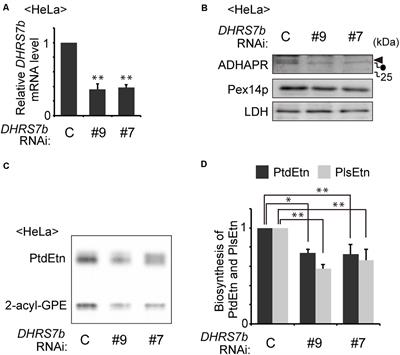 Distinct Functions of Acyl/Alkyl Dihydroxyacetonephosphate Reductase in Peroxisomes and Endoplasmic Reticulum